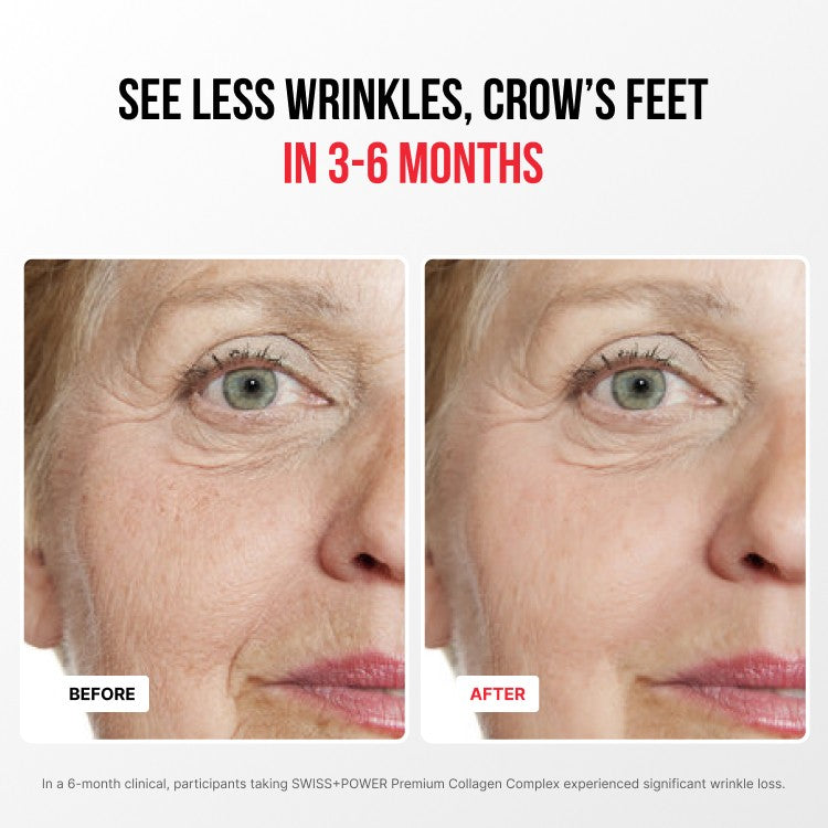 Premium Collagen Complex