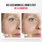 Premium Collagen Complex